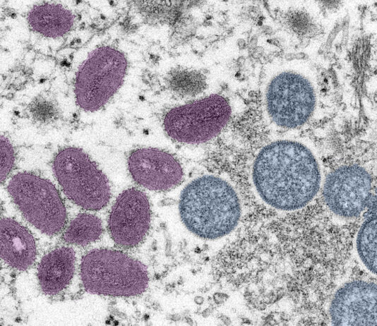 Concerns grow over monkeypox outbreak as schools reopen in Monterey County