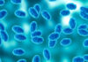 Monterey County sees sharp rise in whooping cough cases Colony of the Bordetella pertussis bacterium that causes pertussis, a whooping cough